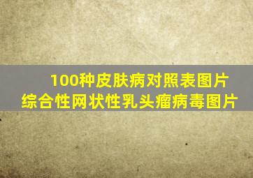 100种皮肤病对照表图片综合性网状性乳头瘤病毒图片