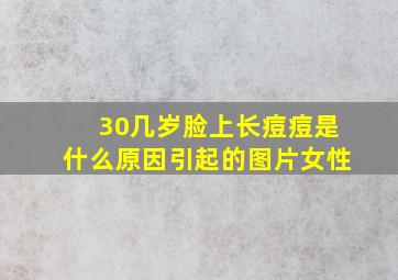 30几岁脸上长痘痘是什么原因引起的图片女性