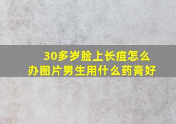 30多岁脸上长痘怎么办图片男生用什么药膏好