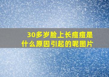 30多岁脸上长痘痘是什么原因引起的呢图片