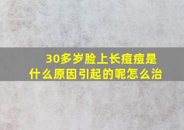 30多岁脸上长痘痘是什么原因引起的呢怎么治