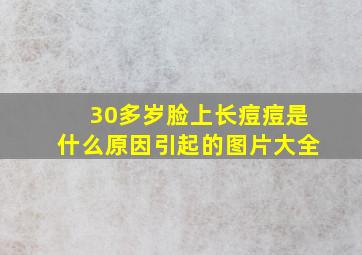 30多岁脸上长痘痘是什么原因引起的图片大全