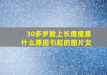 30多岁脸上长痘痘是什么原因引起的图片女