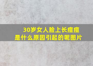 30岁女人脸上长痘痘是什么原因引起的呢图片