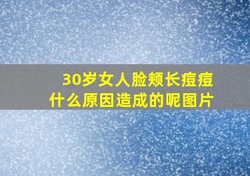 30岁女人脸颊长痘痘什么原因造成的呢图片