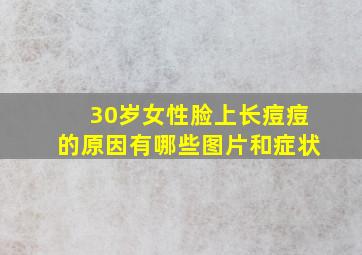 30岁女性脸上长痘痘的原因有哪些图片和症状