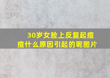 30岁女脸上反复起痘痘什么原因引起的呢图片