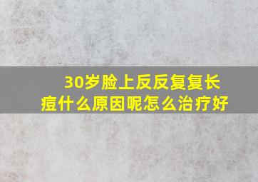 30岁脸上反反复复长痘什么原因呢怎么治疗好