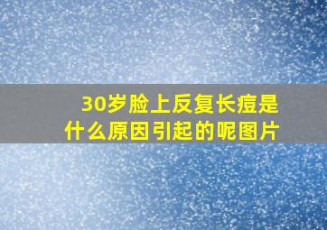 30岁脸上反复长痘是什么原因引起的呢图片