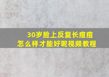 30岁脸上反复长痘痘怎么样才能好呢视频教程