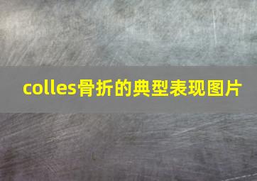 colles骨折的典型表现图片