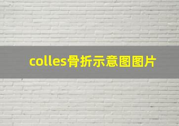 colles骨折示意图图片