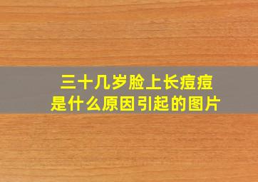 三十几岁脸上长痘痘是什么原因引起的图片