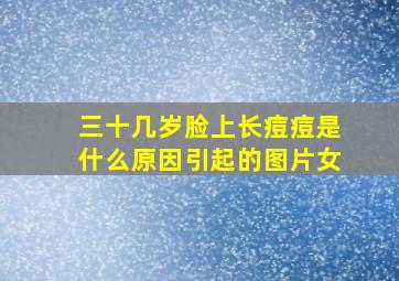 三十几岁脸上长痘痘是什么原因引起的图片女