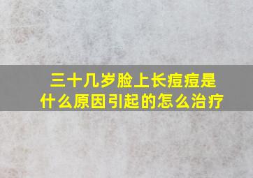 三十几岁脸上长痘痘是什么原因引起的怎么治疗