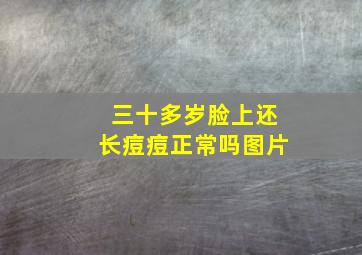 三十多岁脸上还长痘痘正常吗图片