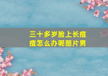 三十多岁脸上长痘痘怎么办呢图片男