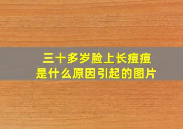 三十多岁脸上长痘痘是什么原因引起的图片