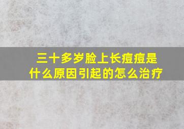 三十多岁脸上长痘痘是什么原因引起的怎么治疗