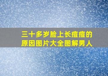 三十多岁脸上长痘痘的原因图片大全图解男人