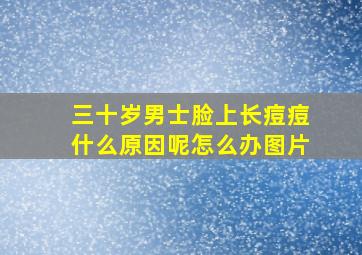 三十岁男士脸上长痘痘什么原因呢怎么办图片