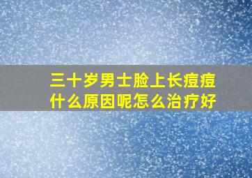 三十岁男士脸上长痘痘什么原因呢怎么治疗好