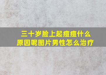 三十岁脸上起痘痘什么原因呢图片男性怎么治疗