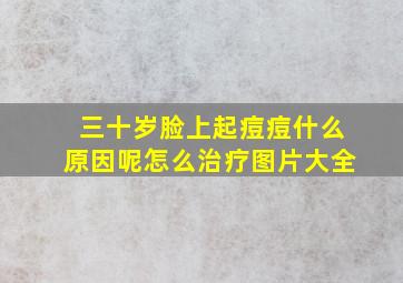 三十岁脸上起痘痘什么原因呢怎么治疗图片大全