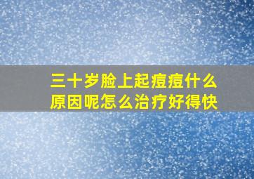 三十岁脸上起痘痘什么原因呢怎么治疗好得快