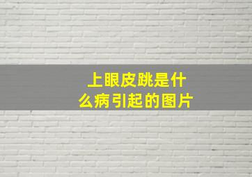 上眼皮跳是什么病引起的图片