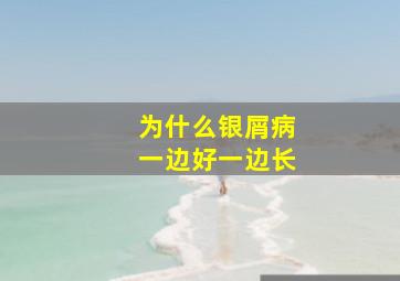 为什么银屑病一边好一边长