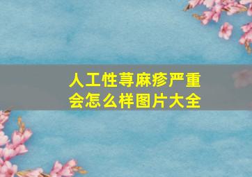 人工性荨麻疹严重会怎么样图片大全