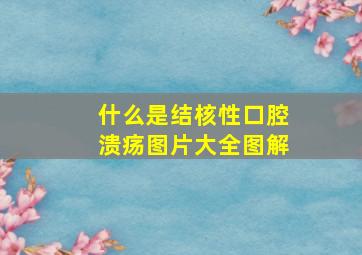 什么是结核性口腔溃疡图片大全图解