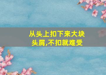 从头上扣下来大块头屑,不扣就难受