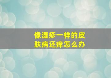 像湿疹一样的皮肤病还痒怎么办