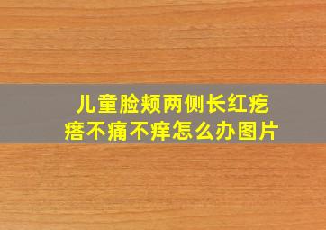 儿童脸颊两侧长红疙瘩不痛不痒怎么办图片