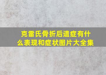 克雷氏骨折后遗症有什么表现和症状图片大全集