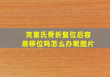 克雷氏骨折复位后容易移位吗怎么办呢图片