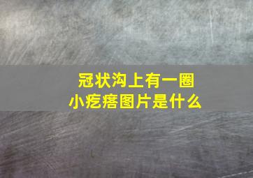 冠状沟上有一圈小疙瘩图片是什么