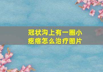 冠状沟上有一圈小疙瘩怎么治疗图片