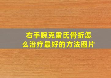 右手腕克雷氏骨折怎么治疗最好的方法图片