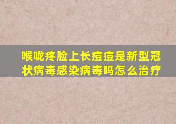 喉咙疼脸上长痘痘是新型冠状病毒感染病毒吗怎么治疗