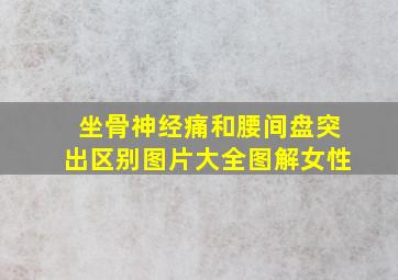 坐骨神经痛和腰间盘突出区别图片大全图解女性