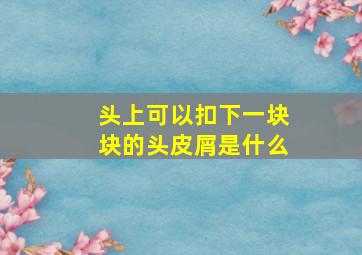 头上可以扣下一块块的头皮屑是什么