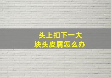 头上扣下一大块头皮屑怎么办