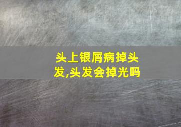 头上银屑病掉头发,头发会掉光吗