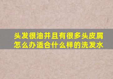 头发很油并且有很多头皮屑怎么办适合什么样的洗发水