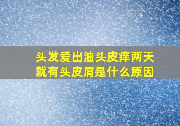 头发爱出油头皮痒两天就有头皮屑是什么原因