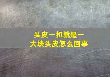 头皮一扣就是一大块头皮怎么回事