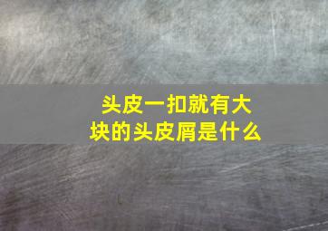 头皮一扣就有大块的头皮屑是什么